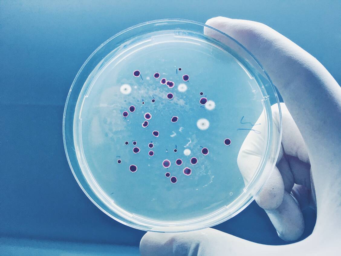 Bakterien mit heruntergefahrenem Stoffwechsel, sogenannte Persister, überstehen meist eine Behandlung mit Antibiotika. / Foto: Shutterstock/KuLouKu