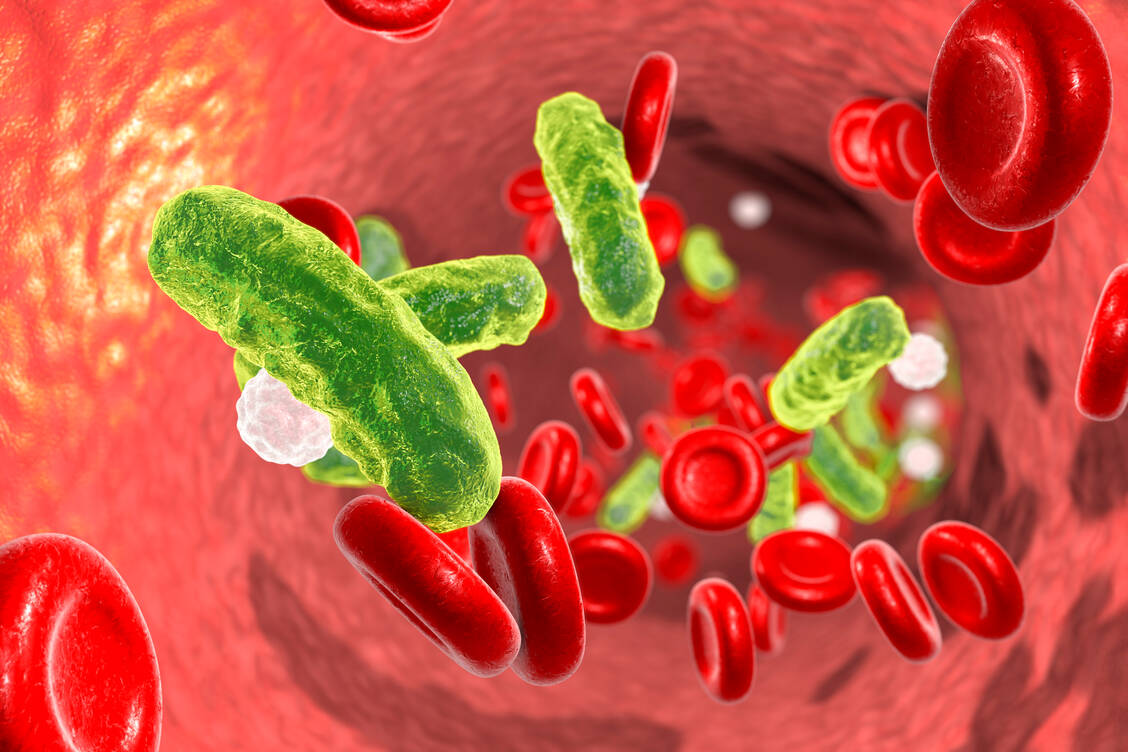 Eine Sepsis wird meist durch Bakterien verursacht. Es kommt zu einer fehlgesteuerten Immunantwort und in der Folge zu lebensbedrohlichem Multiorganversagen. / Foto: Getty Images/Kateryna Kon