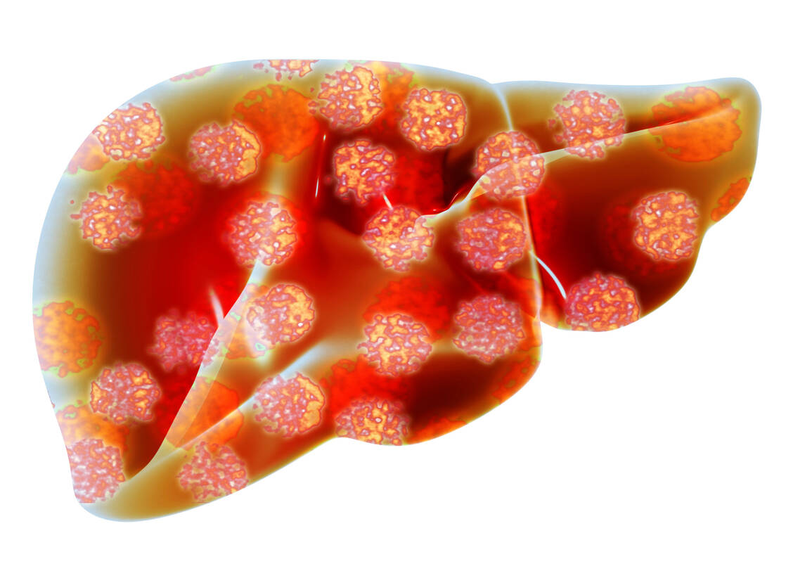 Viren brauchen zum Eintritt in die Wirtszelle bestimmte Rezeptoren. Blockiert man diese pharmakologisch, lässt sich die Infektion verhindern. / Foto: Getty Images/Alfred Pasieka/Science Photo Library