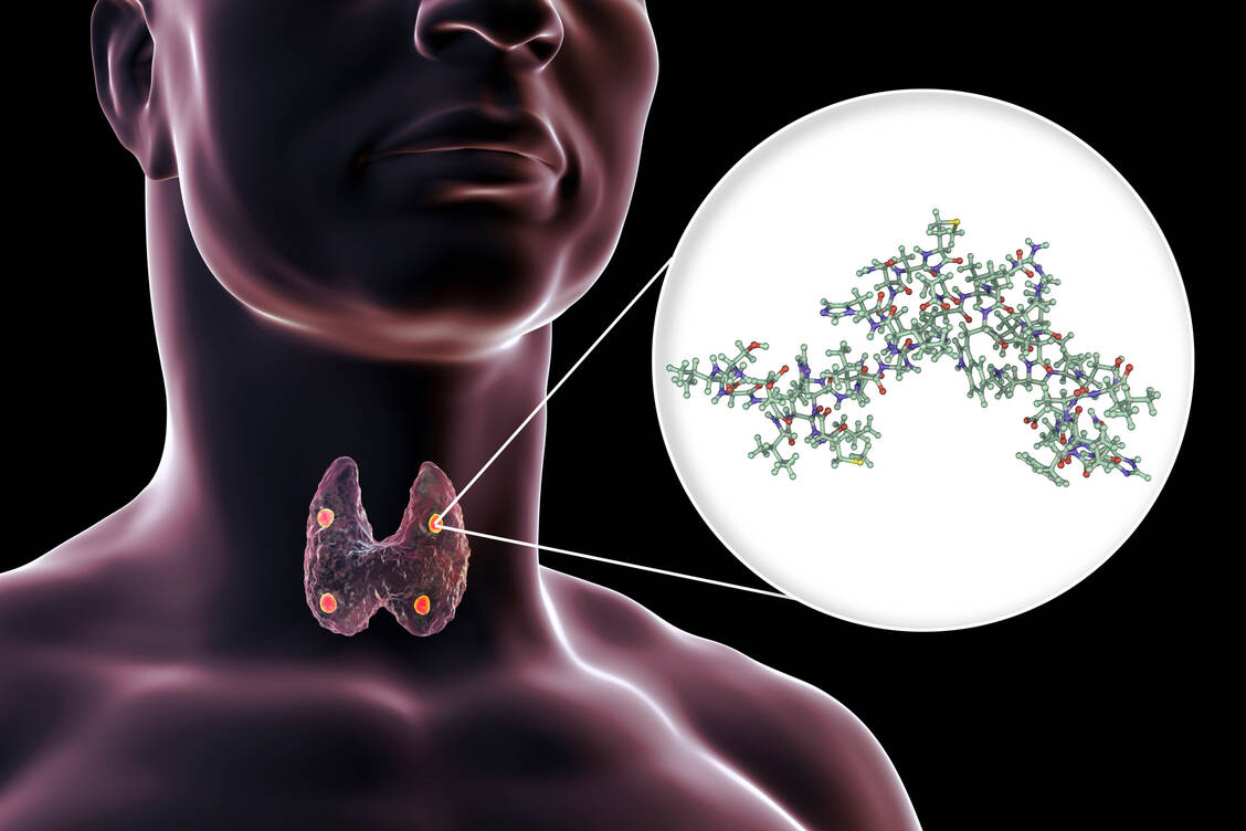 Bei der seltenen Erkrankung Hypoparathyreoidismus produzieren die Nebenschilddrüsen zu wenig oder kein Parathormon. Für Betroffene ist mit Yorvipath eine weitere Substitutionstherapie im Handel. / Foto: Adobe Stock/Dr_Microbe