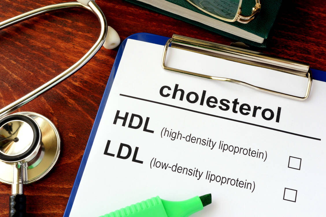 Die antiretrovirale HIV-Therapie kann zu einer Erhöhung des LDL-Cholesterols führen und zudem die Zusammensetzung der Lipoproteine
verändern. / Foto: Adobe Stock/Vitalii Vodolazskyi