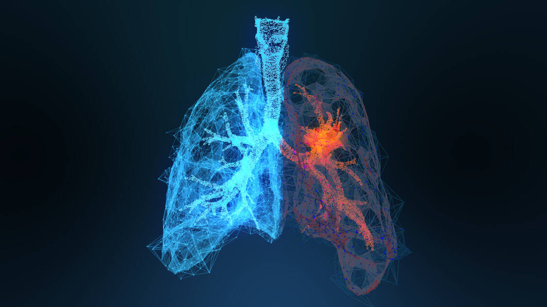 Mit Sugemalimab könnte bald ein weiterer Antikörper für die Immuntherapie bei Lungenkrebs zur Verfügung stehen. Sein Wirkmechanismus ist nicht neu. / Foto: Adobe Stock/appledesign