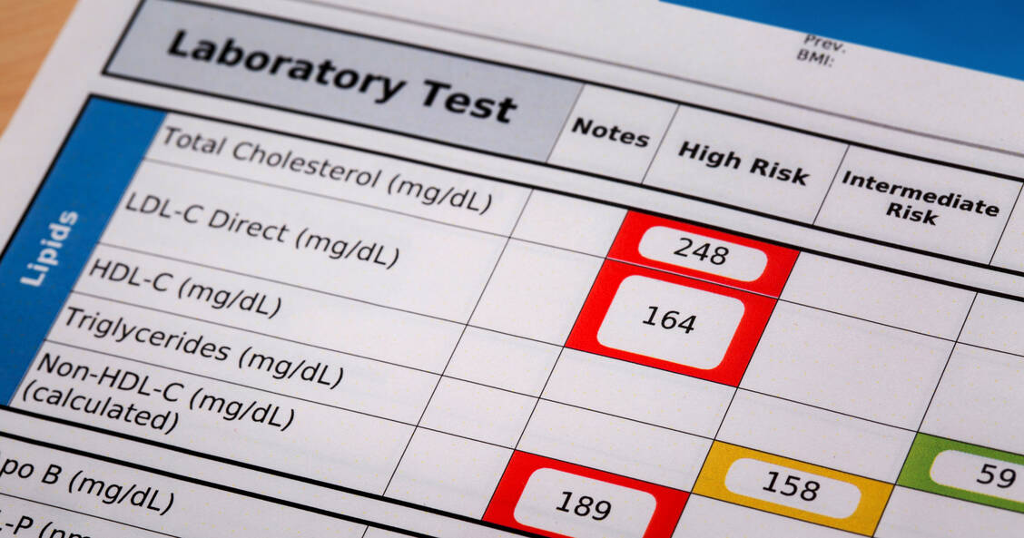 Gesamtcholesterol, LDL- und HDL-Cholesterol werden relativ häufig bestimmt. Die Höhe des Lipoproteins(a) sollte wenigstens einmal im Leben geprüft werden. Das wird bisher aber noch zu selten gemacht, obwohl es weder aufwendig noch teuer wäre. / Foto: Adobe Stock/MarekPhotoDesign.com