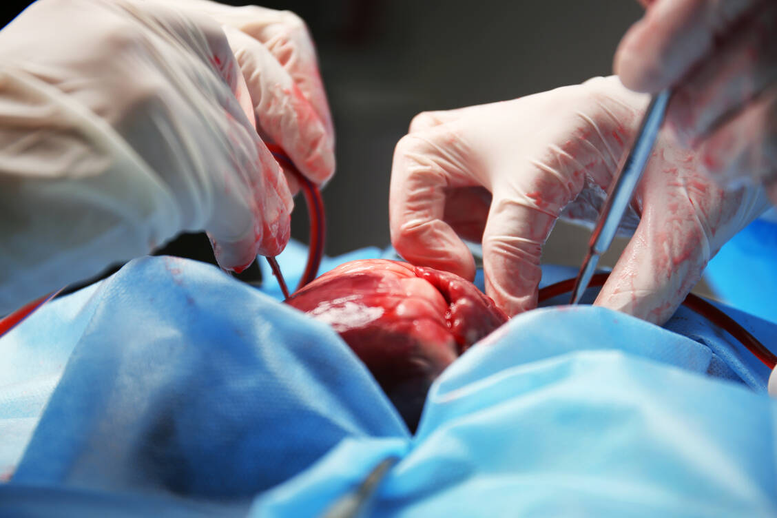 Inzwischen ist die Herztransplantation ein etabliertes Verfahren. Pro Jahr werden in Deutschland etwa 300 Herzen verpflanzt. / Foto: Shutterstock/Africa Studio