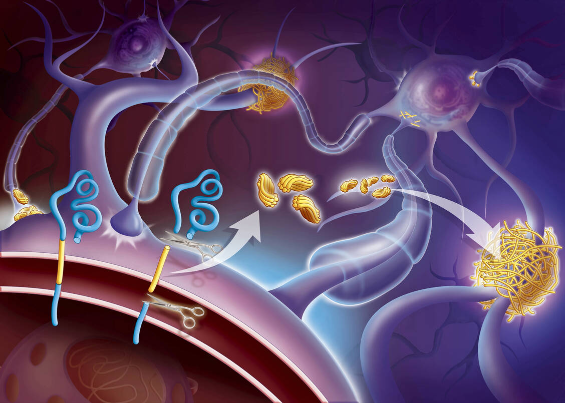 Zwei Sekretasen zerlegen das Amyloid Precursor Protein in Stücke, wobei β-Amyloid entsteht. Dies lagert sich zu Oligomeren und schließlich zu Plaques zusammen. / Foto: Picture Alliance