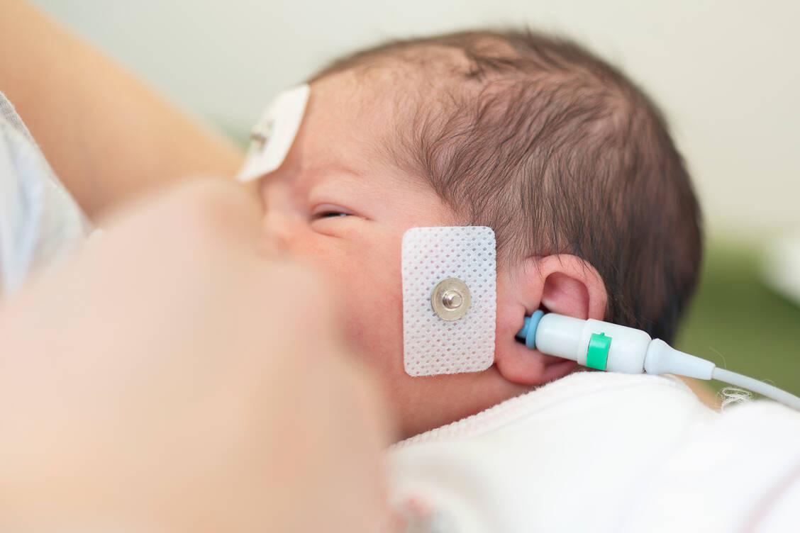Ein Hörtest gehört zum Neugeborenen-Screening und wird in der Regel direkt im Krankenhaus durchgeführt. / Foto: Getty Images/isayildiz