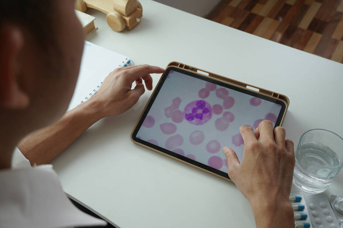 Bei bisher 27.000 in den USA verabreichten Dosen eines CAR-T-Zell-Therapeutikums sind 22 Fälle von sekundären T-Zell-Krebserkrankungen aufgetreten (Symbolbild). / Foto: Getty Images/Chayaporn Yemjuntuek