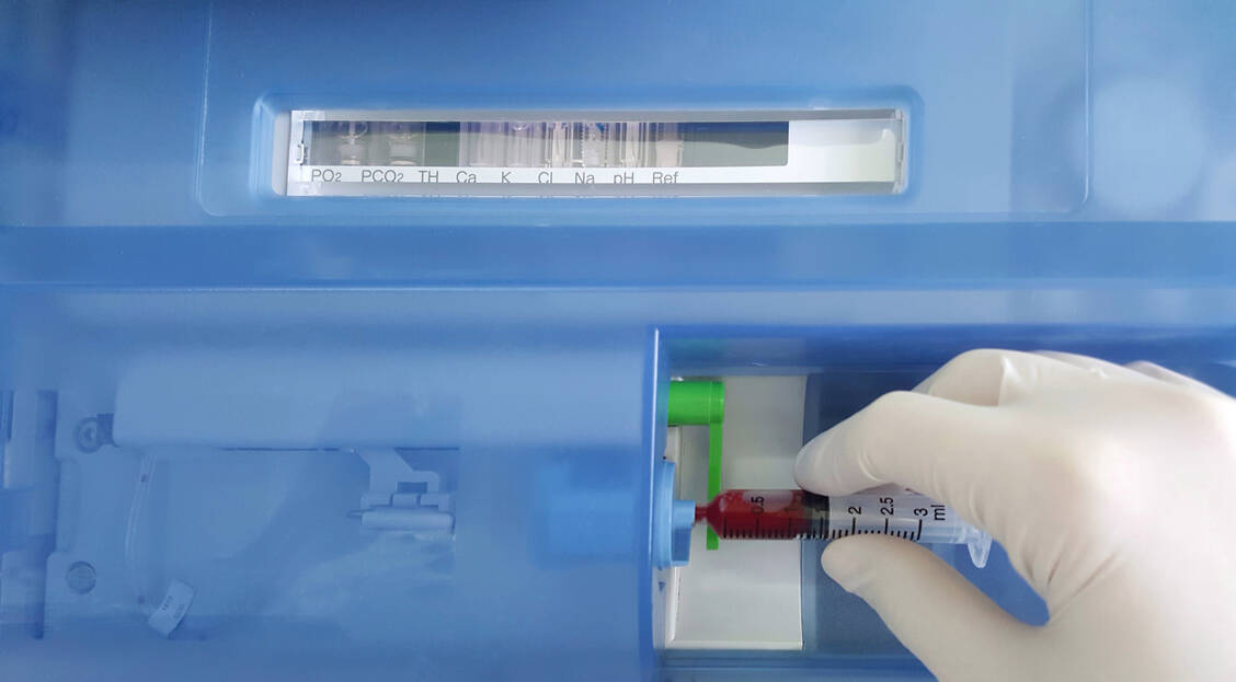 Bei der Blutgasanalyse werden Parameter wie der Sauerstoff- und Kohlendioxidpartialdruck sowie der pH-Wert aus arteriellem Vollblut bestimmt. / Foto: Adobe Stock/Chamaiporn