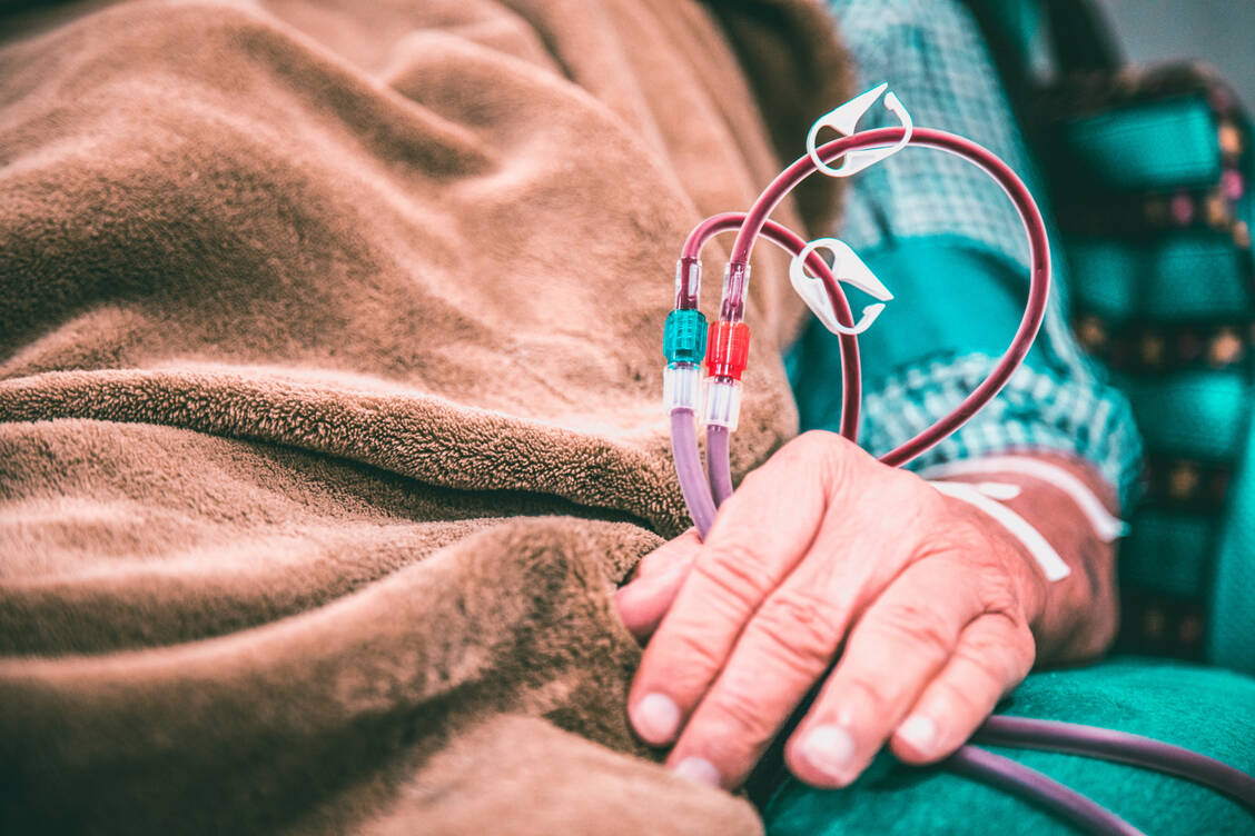 Dreimal in der Woche müssen Dialysepatienten zur Blutwäsche. Der neue Wirkstoff Difelikefalin wird als Bolusinjektion am Ende der Dialyse beim Rückspülen gegeben. / Foto: Getty Images/Mailson Pignata