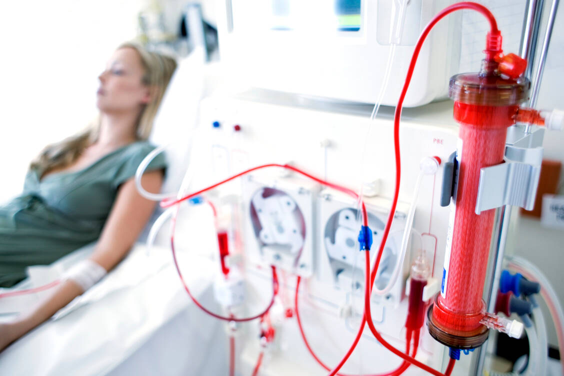Eine unbehandelte oder schwer verlaufende Lupusnephritis kann bis zu einem Nieren­versagen führen, das eine Dialyse oder Transplantation notwendig macht. / © Getty Images/Science Photo Library