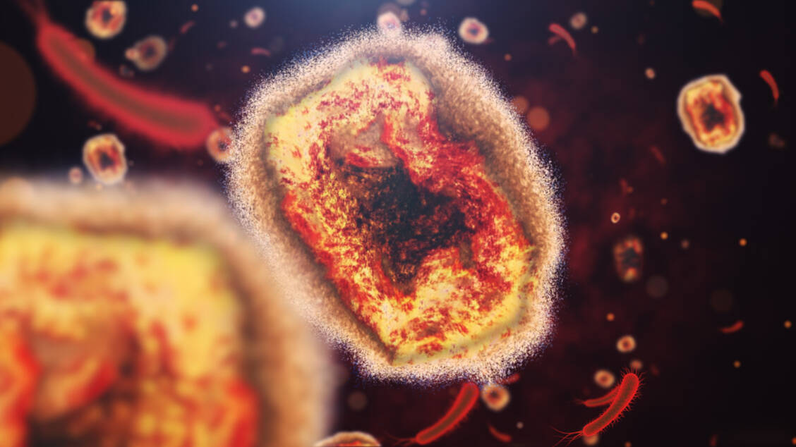 Affenpockenviren sind DNA-Viren, die eng mit den ausgerotteten Pockenviren verwandt sind.  / Foto: Getty Images/kontekbrothers