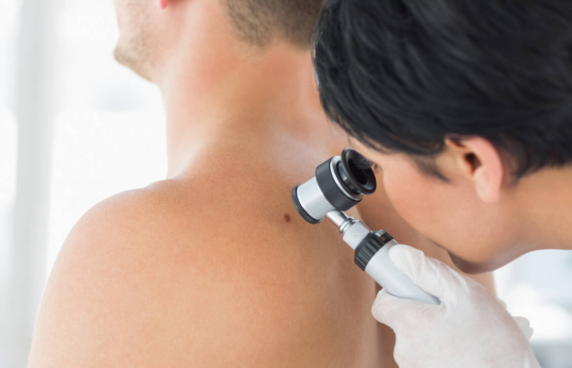 Hautkrebs wird über ein Screening beim Dermatologen diagnostiziert. Auffällige Hautveränderungen werden biopsiert und unter dem Mikroskop begutachtet. / Foto: Adobe Stock/WavebreakmediaMicro