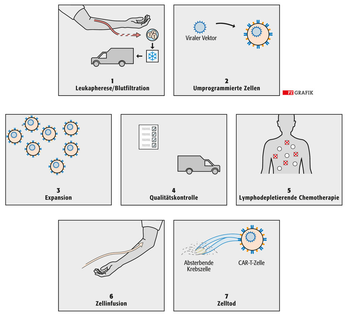 Ablauf einer CAR-T-Zelltherapie / Foto: PZ/Spitzer