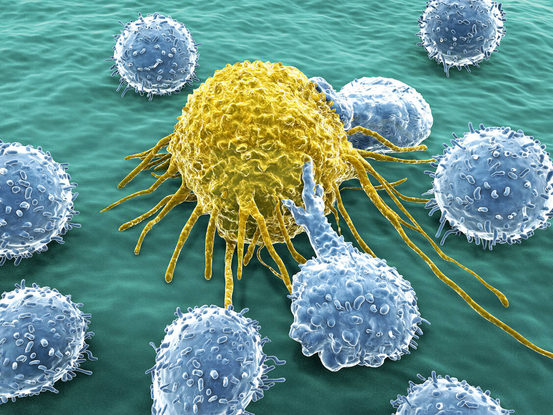 T-Zellen können Krebszellen erkennen und bekämpfen, wenn diese bestimmte Oberflächenmerkmale haben. Mit der CAR-T-Zelltherapie wird den Immunzellen dies künstlich beigebracht. / Foto: Fotolia/Juan Gärtner