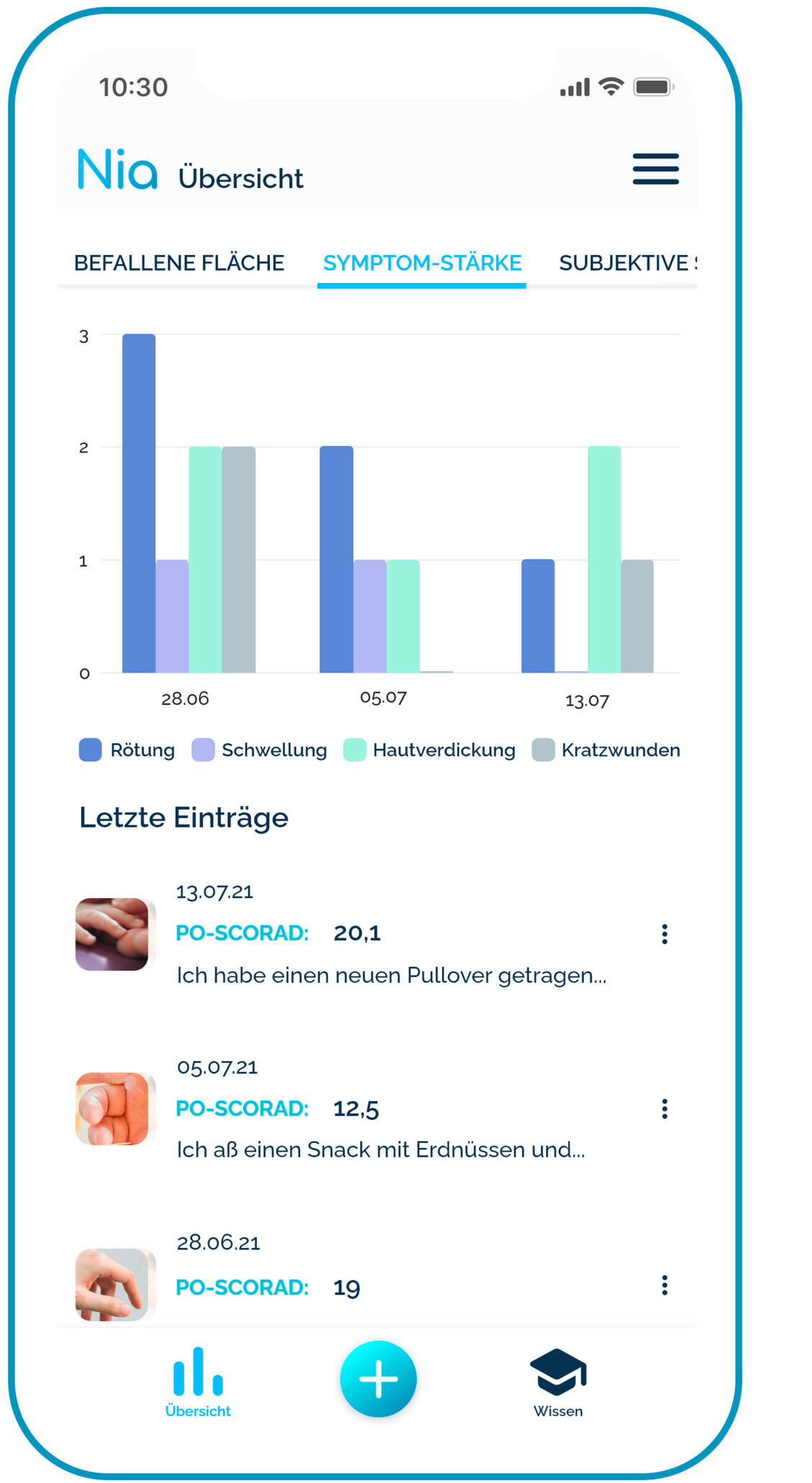 Hautscores helfen Betroffenen, ihren Hautzustand selbst einzuschätzen. / Foto: Nia Health