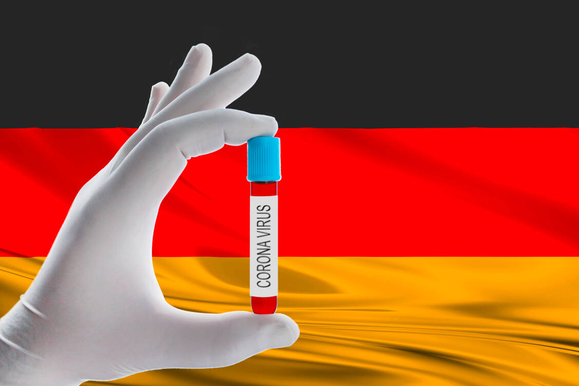 Die Ausweitung der Tests soll auch asymptomatische Infektionen mit dem Coronavirus zu Tage bringen und eine mögliche Verbreitung verhindern. Zum Start des internationalen Reiseverkehrs öffnet auch am Frankfurter Flughafen ein neues Testzentrum..  / Foto: Getty Images/blueshot