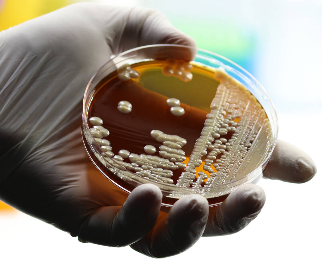 Der massenhafte Einsatz von Antibiotika erhöht den Selektionsdruck auf Bakterien und fördert Resistenzen. Es werden dringend neue Reserveantibiotika benötigt. Ein solches ist die Fixkombination aus Aztreonam und Avibactam. / Foto: Adobe Stock/TopMicrobialStock