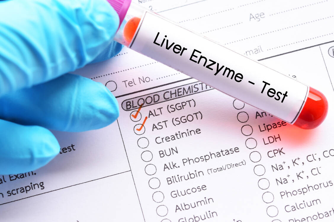 Da es während der Therapie mit Tucatinib zum deutlichen Anstieg der Leberenzyme AST und ALT sowie von Bilirubin kommen kann, sollten diese Parameter engmaschig kontrolliert werden. / Foto: Adobe Stock/jarun011