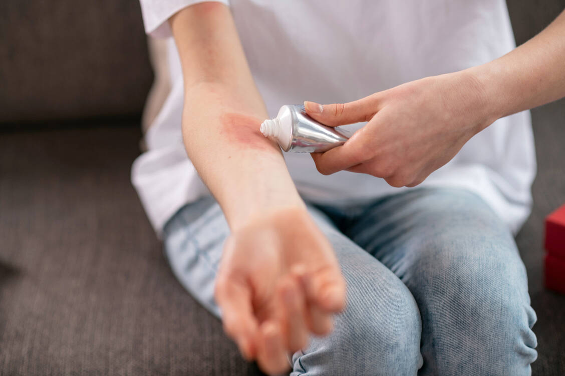 Salben, Cremes und Gele sind unverzichtbar in der topischen Therapie, aber sie können nicht alle Anwendungsprobleme lösen. Daher wird viel geforscht an innovativen Darreichungsformen. / © Adobe Stock/zinkevych