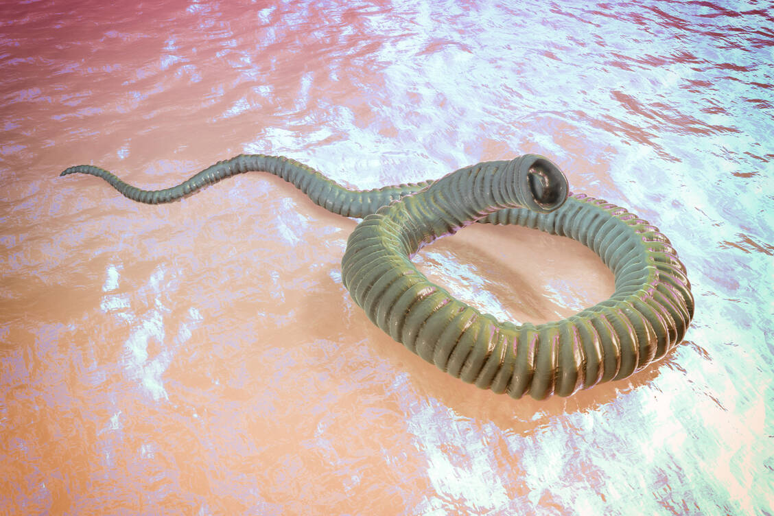 Mit dem Guineawurm  waren im Jahr 2021 nur noch 14 Menschen weltweit infiziert. / Foto: Getty Images/Science Photo Library