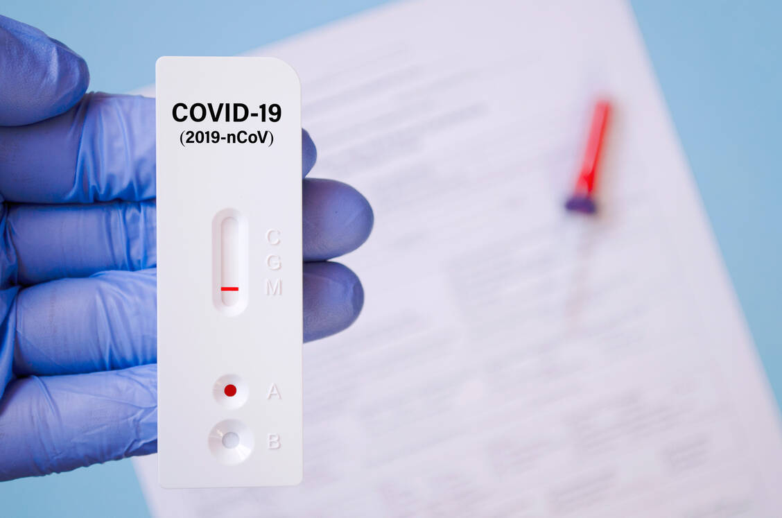Bisher verfügbare Antigentests gelten zwar noch nicht als hundertprozentig zuverlässig. Der Berliner Virologe Professor Dr. Christian Drosten plädiert trotzdem für ihren Einsatz zum Start der Erkältungssaison. / Foto: Getty Images/undefined undefined
