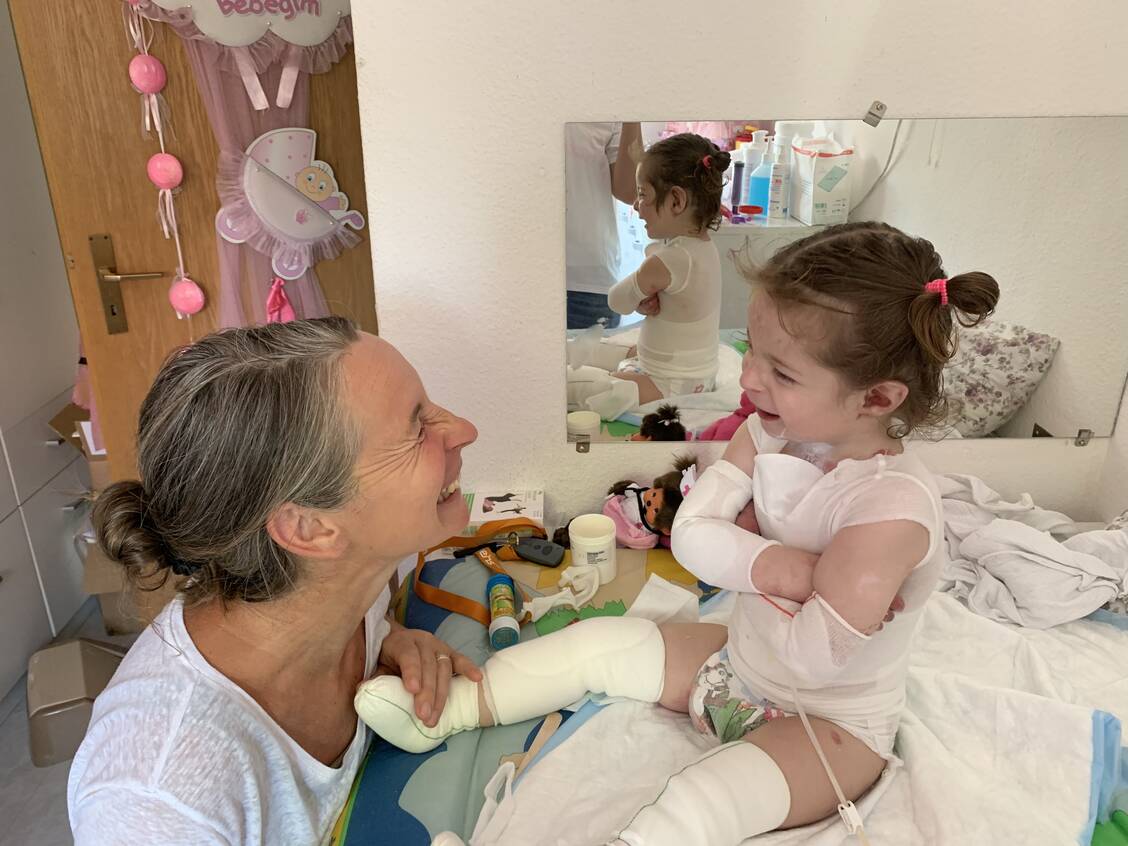 Den »Schmetterlingskindern« können schon kleinste Berührungen Verletzungen zufügen. Trotzdem genießen sie wie alle Kinder zarte Streicheleinheiten und Zuwendung. / Foto: DermaKIDS e.V.