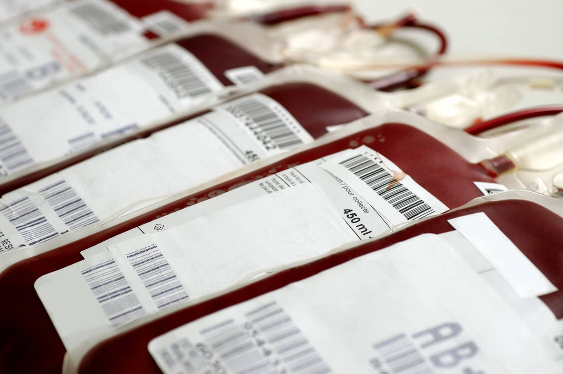 Bei asymptomatischen und leichten SARS-CoV-2-Infektionen ist kein Virus im Blut der Infizierten zu finden, berichtet das Paul-Ehrlich-Institut. / Foto: Adobe Stock/Vlad