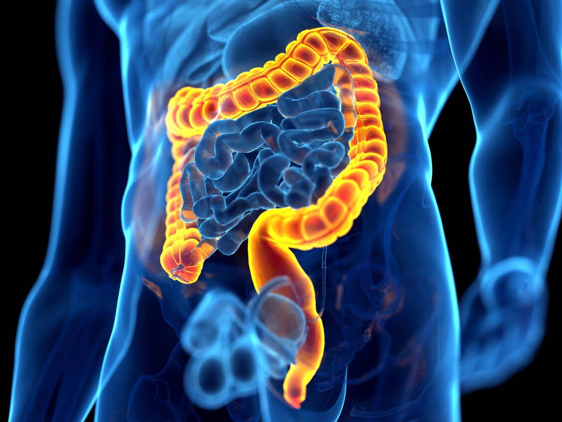 Bei der Colitis ulcerosa kommt es zu Entzündungen im Dickdarm, die sich vom Mastdarm (Rektum) aus über das gesamte Colon ausbreiten können.  / Foto: Getty Images/Science Photo Library/Sebastian Kaulitzki