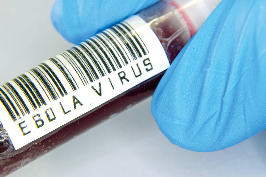 Bei dem großen Ausbruch im Ostkongo haben sich innerhalb von zwei Jahren fast 3500 Menschen mit dem Ebolavirus infiziert, 2880 sin din der Folge gestorben. / Foto: Shutterstock/ChiccoDodiFC