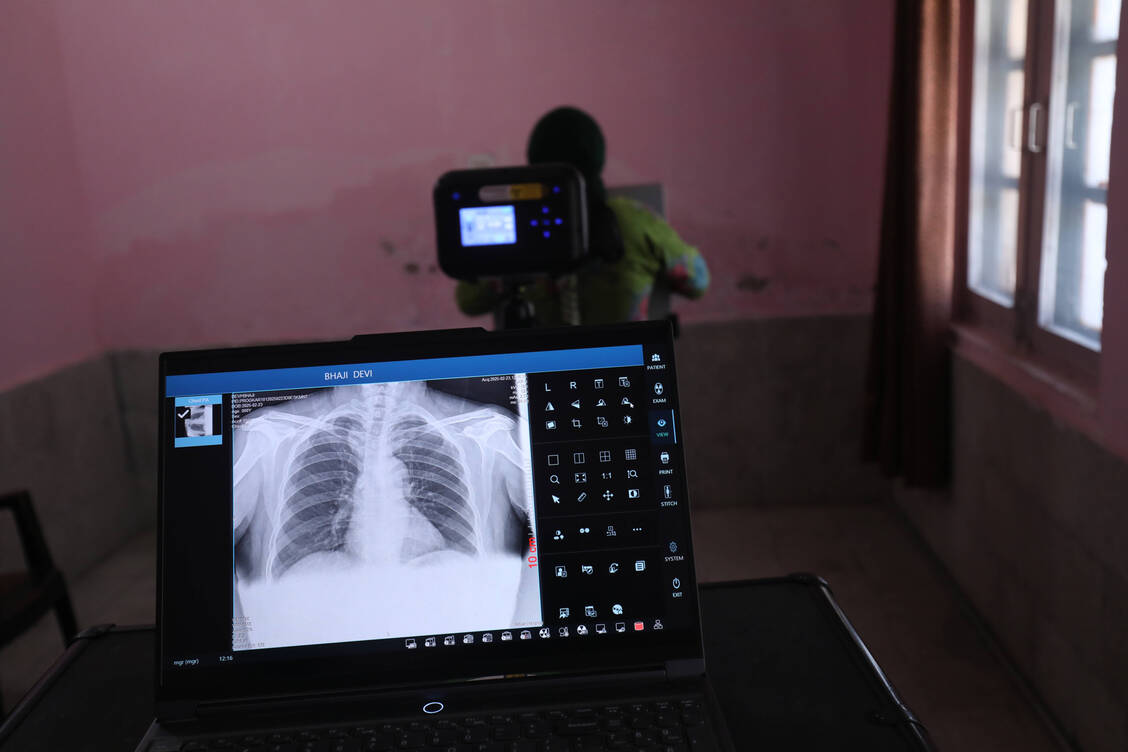 Bei einer indischen Dorfbewohnerin wird ihm Rahmen einer Kampagne zur Elimination der Tb ein Röntgenbild gemacht. / © Imago Images/Matrix Images