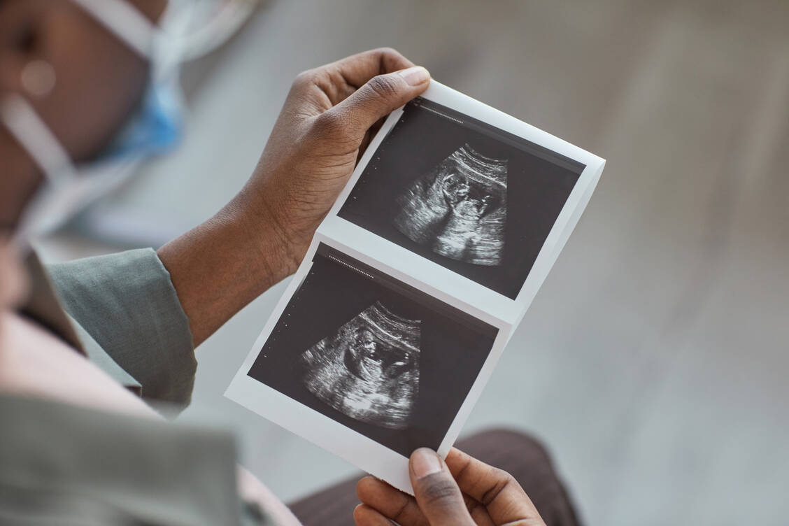 In der Regel sprechen Frauenärzte das Thema Pränataldiagnostik kurz nach Feststellung einer Schwangerschaft an. Falls gewünscht, führt der Arzt dann gegebenenfalls Untersuchungen wie eine Nackenfaltenmessung des Fetus durch. / Foto: Getty images/SeventyFour