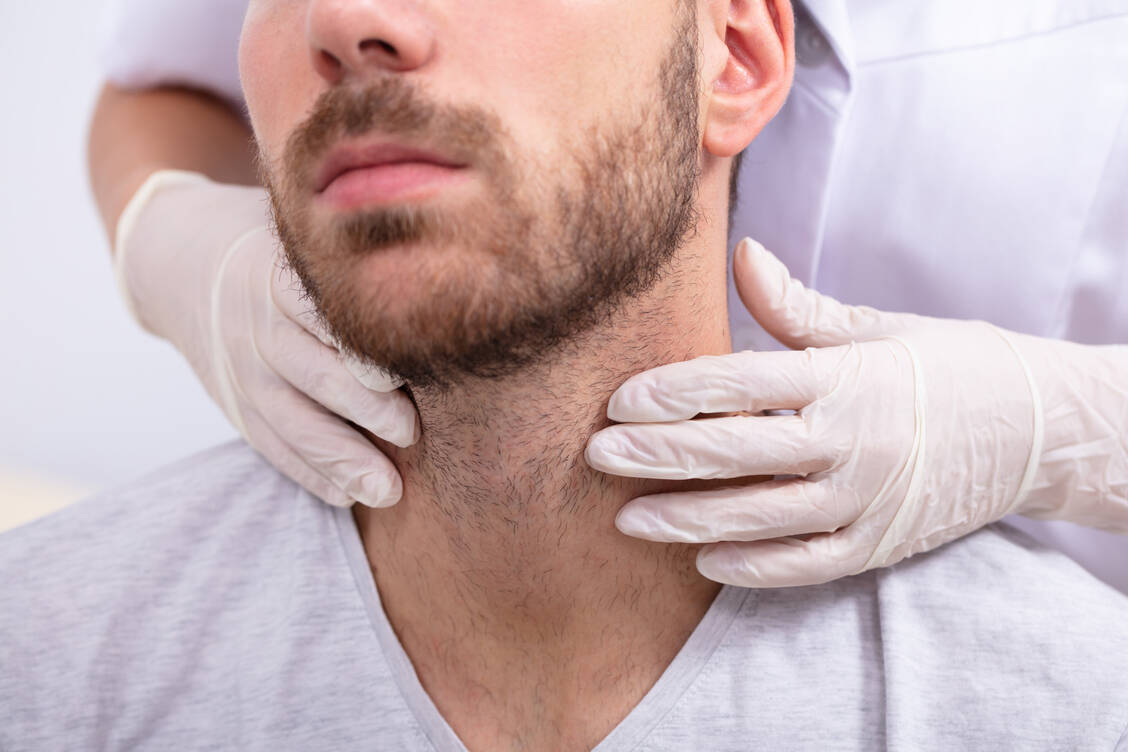 Lymphknotenschwellungen sind mögliche Anzeichen eines Lymphoms, einer aggressiven bösartigen Erkrankung des lymphatischen Systems. / Foto: Adobe Stock/Andrey Popov
