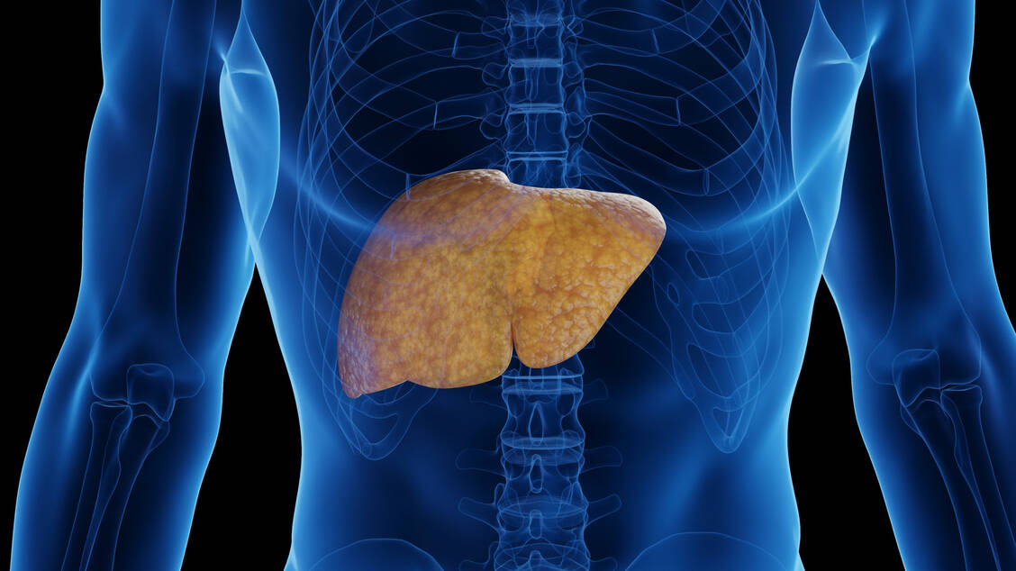 In den USA wurde ein erster Arzneistoff zur Behandlung der Metabolic Dysfunction-associated Steatohepatitis (MASH, ehemals NASH) zugelassen. Auch bei der Europäischen Arzneimittelagentur EMA wird derzeit ein Zulassungsantrag für Resmetirom geprüft. / Foto: Adobe Stock/ Sebastian Kaulitzki