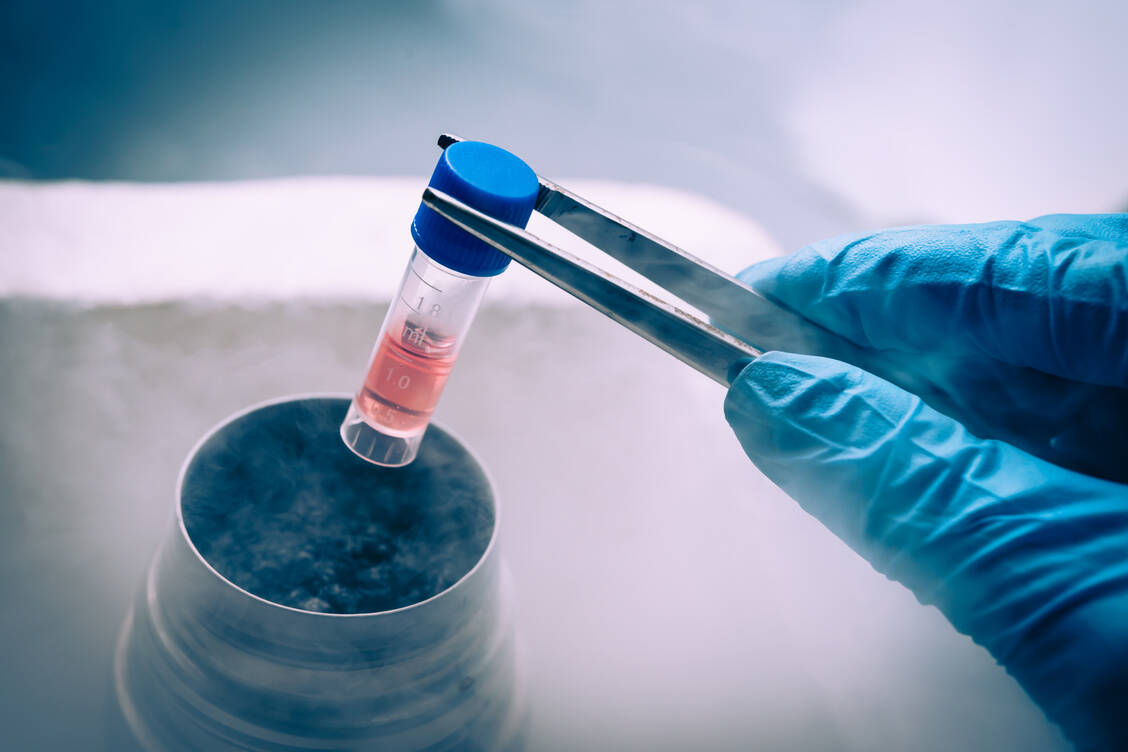 Flüssiger Stickstoff wird häufig zur Lagerung von Zellen verwendet, um deren Langlebigkeit und Funktionalität zu gewährleisten. / Foto: Adobe Stock/sola_sola