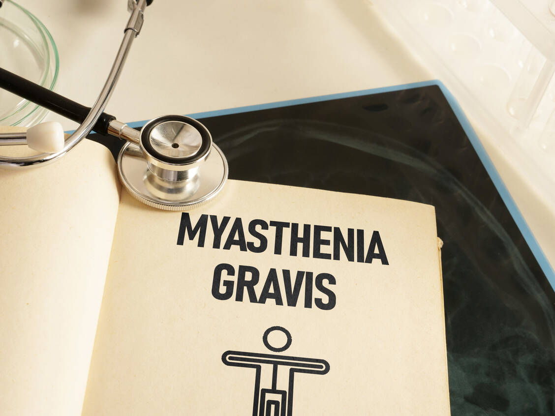 Für die Behandlung der Myasthenia gravis sind in den vergangenen Jahren einige neue Therapieoptionen hinzugekommen. Nipocalimab könnte zukünftig als weiterer FcRn-Blocker folgen. / Foto: Adobe Stock/ Andrii