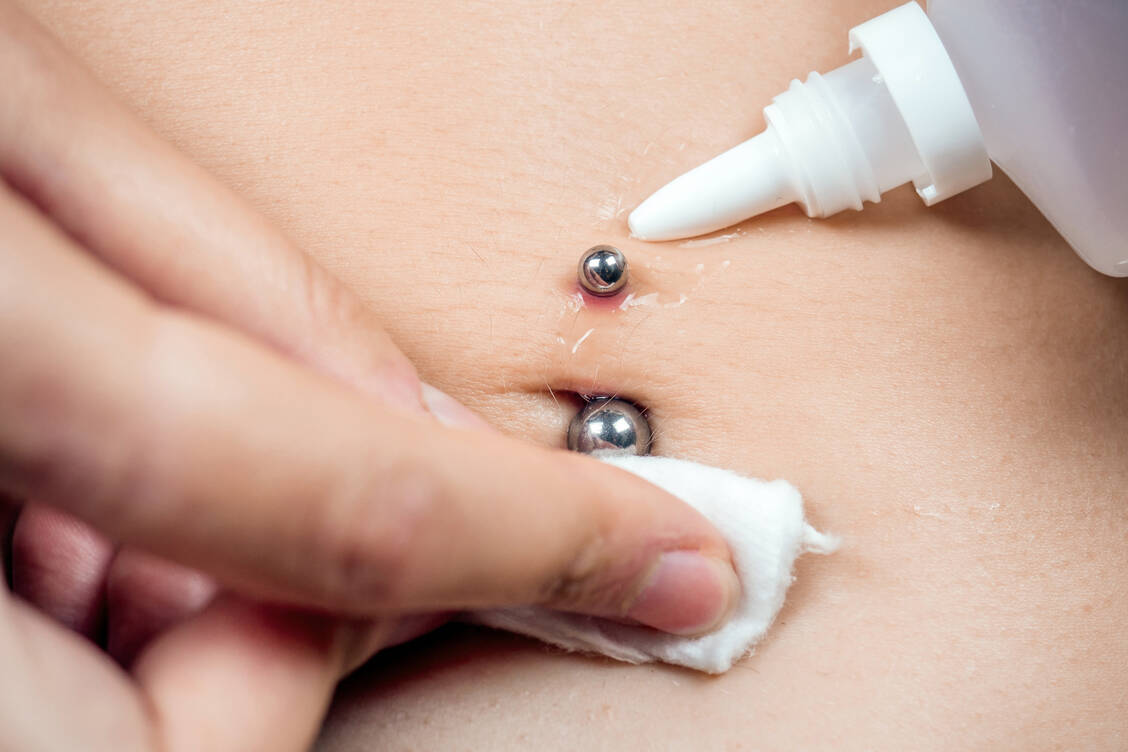 Ob in der Zunge, der Nase, den Lippen oder im Bauchnabelbereich: Ein Piercing geht mit einer Gewebezerstörung im Stichkanal einher, die besondere Maßnahmen zur Heilungsförderung erforderlich machen kann. / Foto: Adobe Stock/Yuri Krasilnikov
