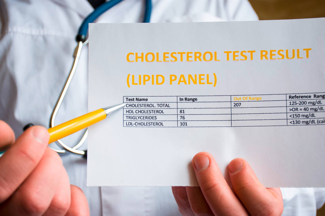 Heute strebt man beim LDL-Cholesterol deutlich niedrigere Werte an als früher. Mittel der Wahl sind hochpotente Statine. / Foto: Getty Images/Shidlovski