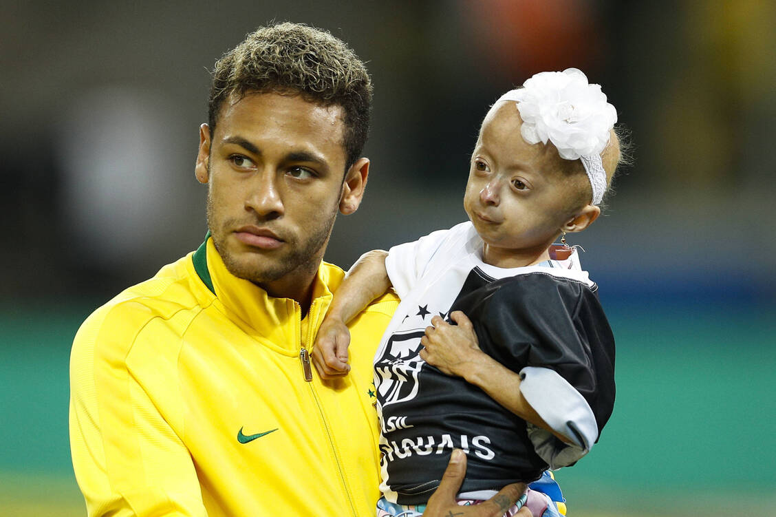 Der brasilianische Fußballspieler Neymar kümmerte sich vor einem Spiel um einen an Progerie erkrankten Fan.  Zur Behandlung des Hutchinson-Gilford-Progerie-Syndroms wurde in der EU mit Lonafarnib erstmal ein Wirkstoff zugelassen. / Foto: Imago Images/Fotoarena