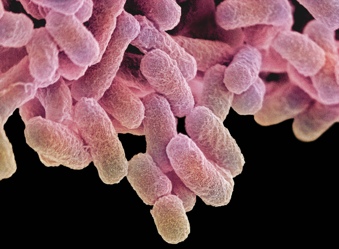Escherichia coli, ein häufiger Erreger von unkomplizierten Harnwegsinfekten, ist laut Fachinformation »üblicherweise empfindlich« gegen Fosfomycin. / Foto: Getty Images/Science Photo Library/Steve Gschmeissner