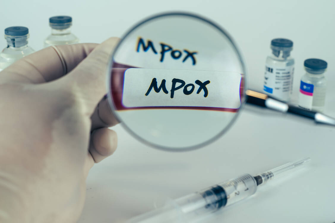 Die Krankheit Mpox wird durch das Affenpockenvirus ausgelöst, ein behülltes DNA-Virus aus der Gattung Orthopoxvirus. / Foto: Adobe Stock/Jun Li