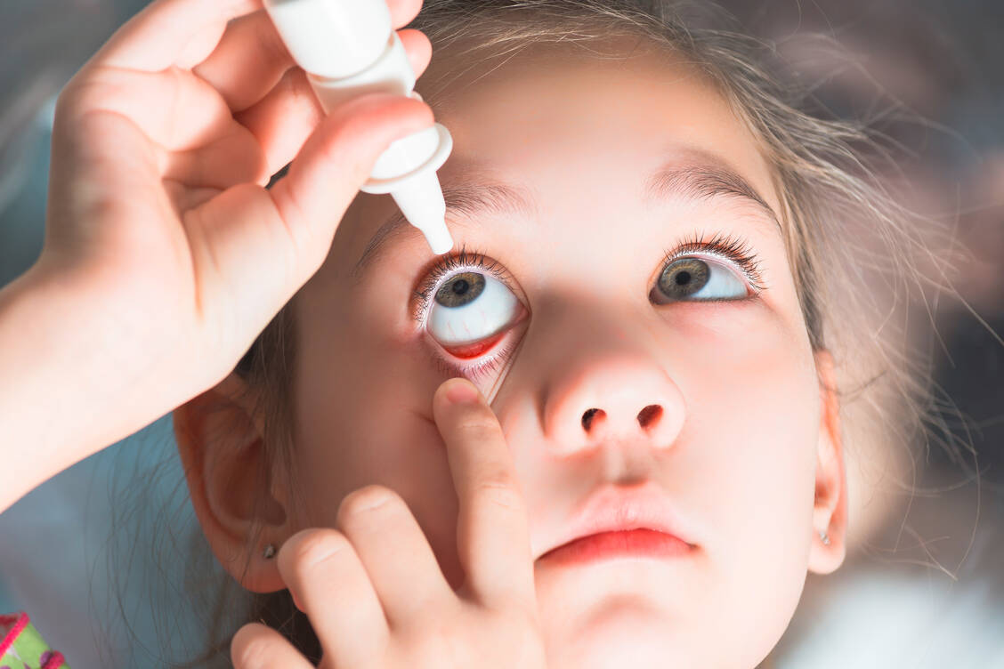 Jeden Abend vor dem Schlafengehen ein Tropfen Atropin-Lösung in jedes Auge – das soll das Fortschreiten von Kurzsichtigkeit bei Kindern drastisch drosseln. / Foto: Adobe Stock/Dinozavr