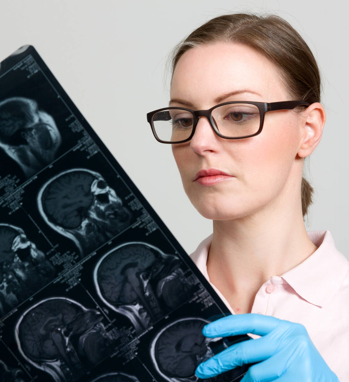 Neben vielen anderen Untersuchungen gehört ein MRT zur Standard-Diagnostik bei Verdacht auf ALS. / Foto: Adobe Stock/StudioLaMagica