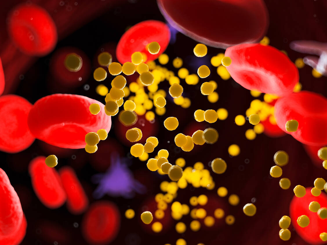 Zu hohe LDL-Konzentrationen im Blut werden in Zusammenhang mit Herz-Kreislauf-Erkrankungen gebracht. Der Arzneistoffkandidat Bempedoinsäure soll helfen, die LDL-Synthese zu drosseln. / Foto: Adobe Stock/Sebastian Kaulitzki
