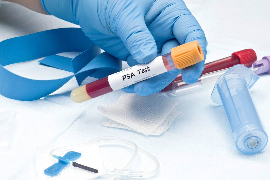 Viele Männer lassen sich zur Prostatakrebsvorsorge auf eigene Kosten lieber Blut abnehmen, als sich abtasten zu lassen.  / Foto: Shutterstock/Sherry Yates