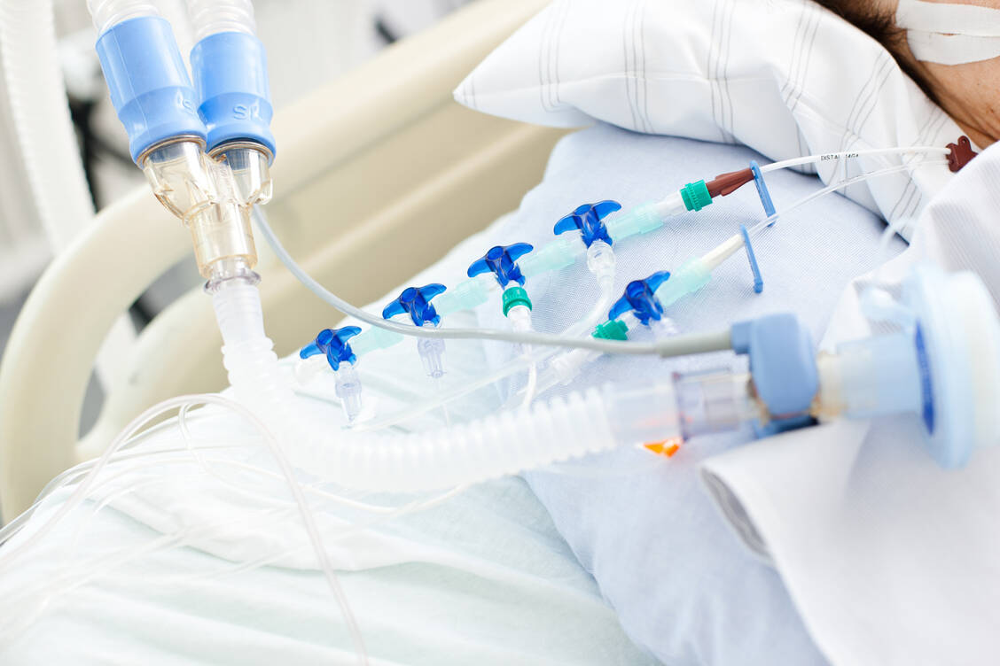 Covid-19-Patienten mit einer schweren akuten respiratorischer Erkrankung (SARI) müssen im Schnitt mehr als doppelt so lange beatmet werden wie Grippe-Patienten mit SARI. / Foto: Adobe Stock/CMP