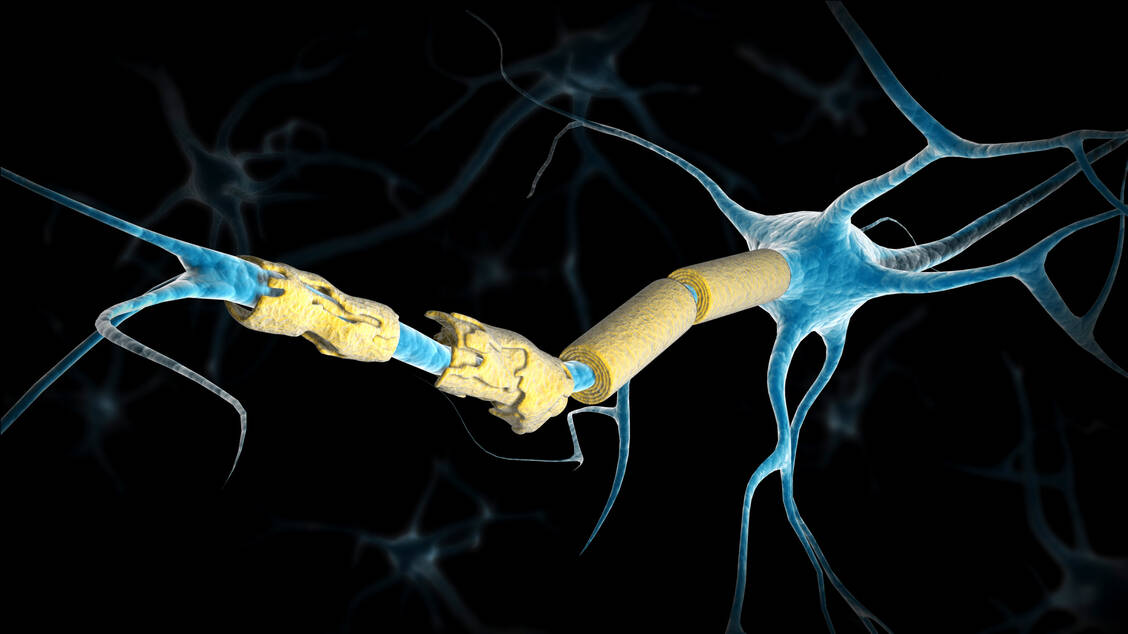 Bei Multipler Sklerose greift das Immunsystem die Myelinscheide um die Nervenfortsätze (Axone) bestimmter Neuronen an.  / © Getty Images/Stocktrek Images
