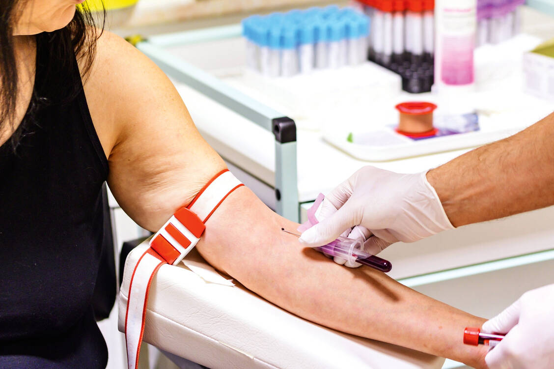 Therapie der Wahl bei Hämochromatose, bei der zu viel Eisen im Körper gespeichert wird, ist der Aderlass. Foto: Fotolia/Ronald Rampsch