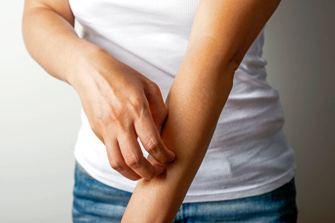 Juckreiz ist eines der Symptome der atopischen Dermatitis, das die Betroffenen stark belastet. / Foto: iStockphoto/simarik