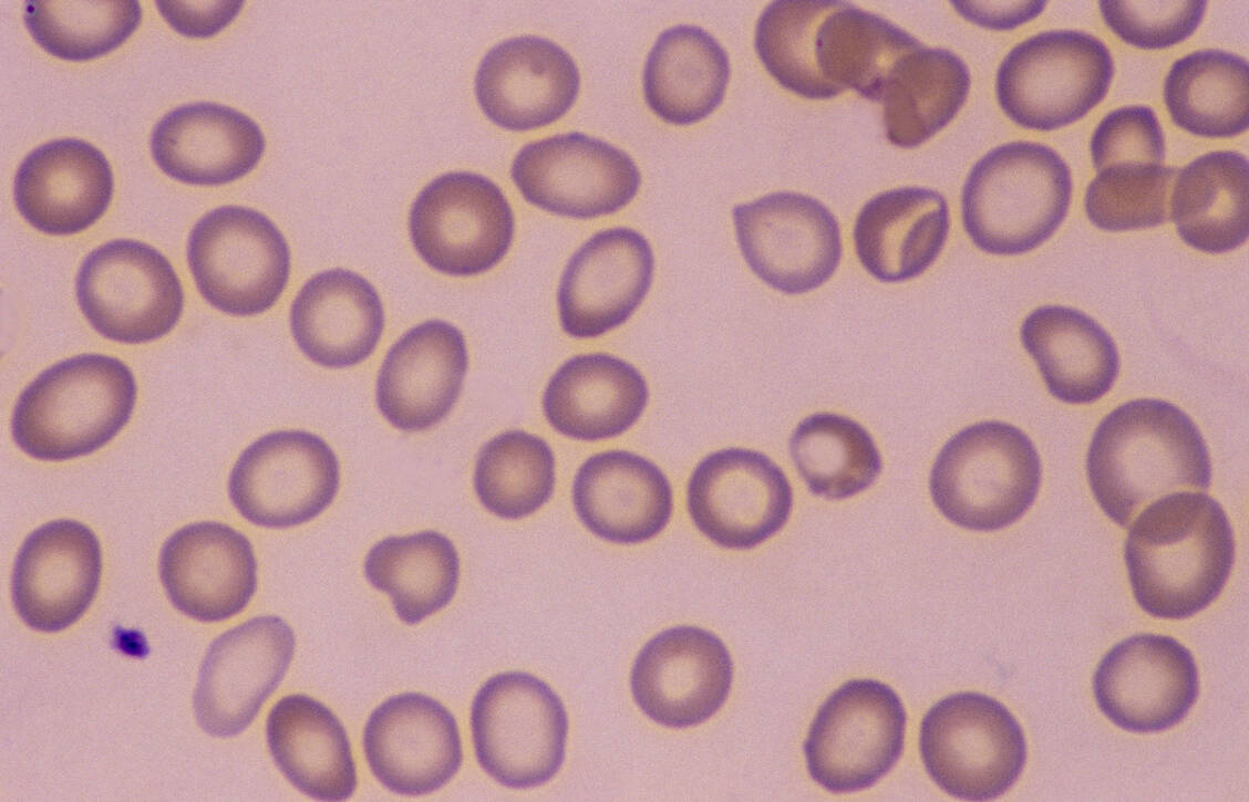 Bei einem Eisenmangel sind die roten Blutkörperchen kleiner und blasser (hypochrom) als normal. / Foto: Getty Images/Ed Reschke