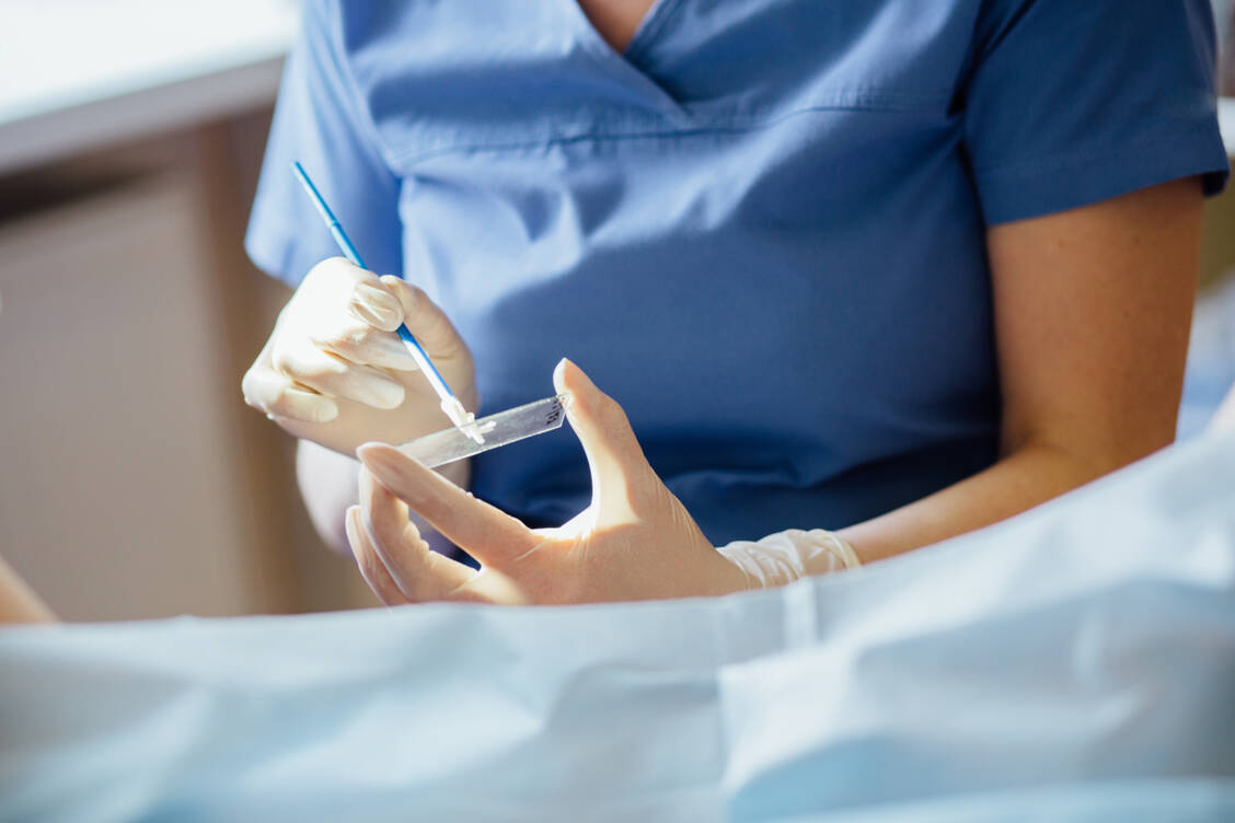 Frauen ab 35 brauchen demnächst nur noch alle drei Jahre zur Krebsvorsorge für Zervixkarzinome. Zum Pap-Abstrich kommt ein HPV-Test hinzu. / Foto: Adobe Stock/Iryna